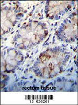 C1QC Antibody (Center)