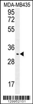 OR4K2 Antibody (C-term)