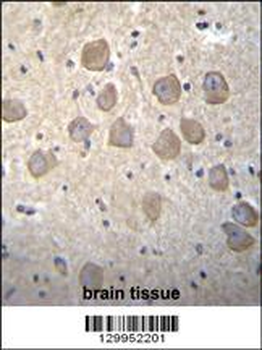 OR4K2 Antibody (C-term)