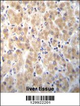 PABPN1L Antibody (Center)