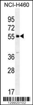SHISA6 Antibody (N-term)