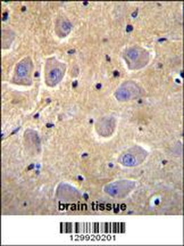 SHISA6 Antibody (N-term)
