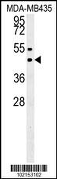 SUV39H1 Antibody