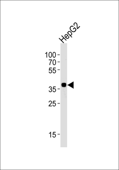 OR2M7 Antibody (C-term)