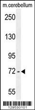 ZBT24 Antibody (N-term)