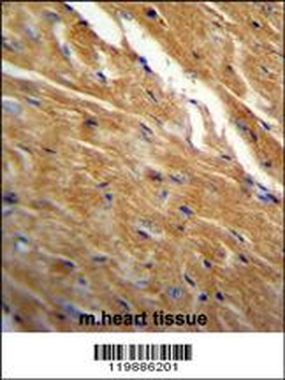 TBC1D13 Antibody (Center)