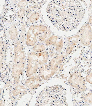 COL8A2 Antibody (C-term)
