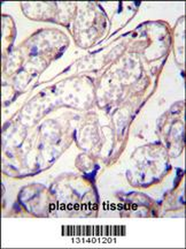 PYCR2 Antibody (Center)