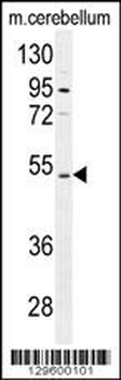CNGA4 Antibody (N-term)