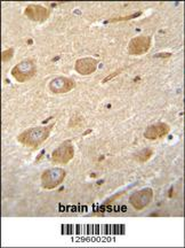 CNGA4 Antibody (N-term)