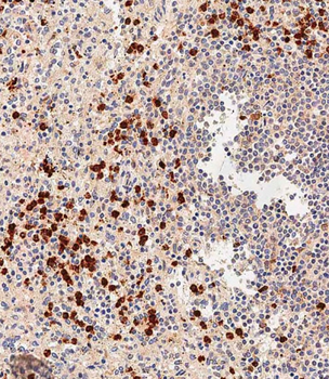 NOD1 Antibody (C-term)