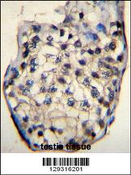 ODF3 Antibody (C-term)