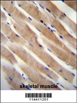 RHEB Antibody (C-term)