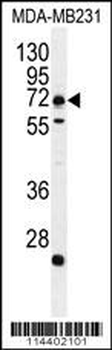 MIC1 Antibody (N-term)