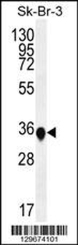 TP53INP1 Antibody (N-term)