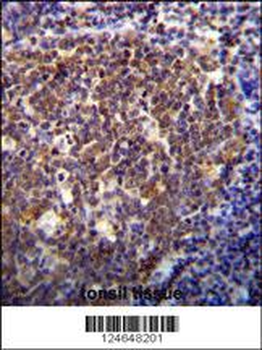 HOXB6 Antibody (Center)