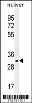 JAZF1 Antibody (N-term)