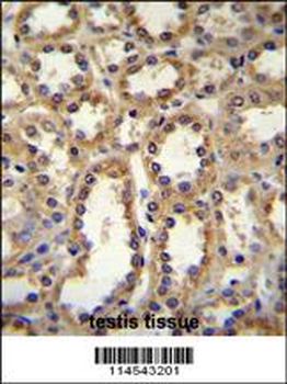 GPC6 Antibody (C-term)