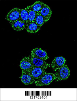 UQCRFS1 Antibody (C-term)