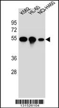 YI016 Antibody (C-term)