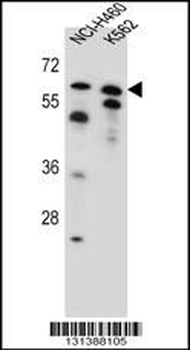 PLAG1 Antibody (N-term)