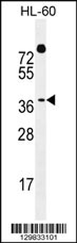 DUX4 Antibody (Center)
