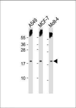 KILLIN Antibody (C-term)