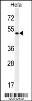 ZMYND17 Antibody (C-term)