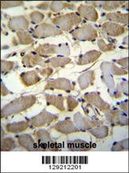 ZMYND17 Antibody (C-term)