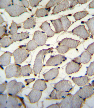 DDX60L Antibody (C-term)