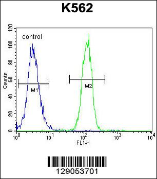 CCDC61 Antibody (N-term)