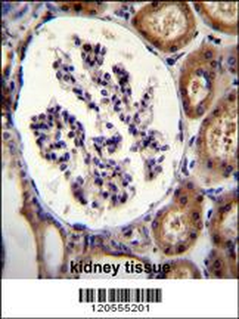 ITGA8 Antibody (C-term)