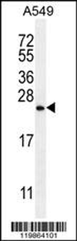 SNX24 Antibody (N-term)