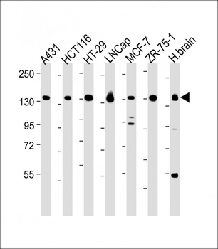 MYO6 Antibody (C-term R1181)