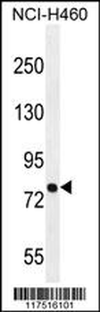 PNN Antibody (Center)