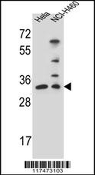 NTHL1 Antibody (Center R103)