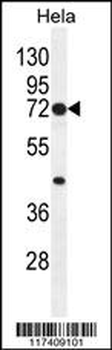 PTGS2 Antibody (Center P378)