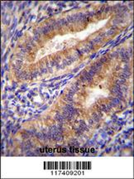 PTGS2 Antibody (Center P378)
