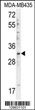 DTWD1 Antibody (Center)