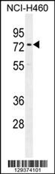 CCDC63 Antibody (C-term)