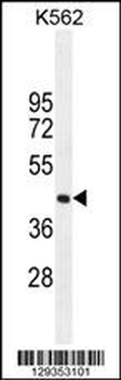 SIGLEC15 Antibody (C-term)