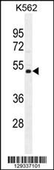 NUDT19 Antibody (Center)