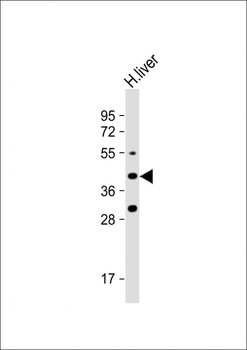 FADS6 Antibody (C-term)