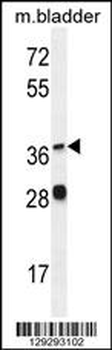 FADS6 Antibody (C-term)