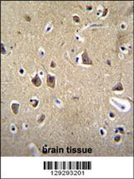 FADS6 Antibody (C-term)