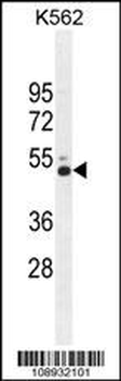 CRFR2 Antibody (D35)