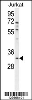 OR5B12 Antibody (C-term)