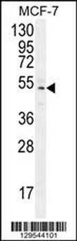 ZNF829 Antibody (Center)