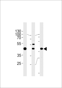 GTF2H2C Antibody (C-term)