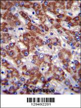 OR2B11 Antibody (C-term)